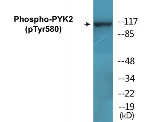 PYK2 (phospho Tyr580) Cell Based ELISA Kit