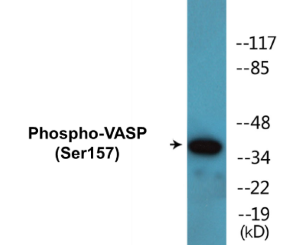 VASP (phospho Ser157) Cell Based ELISA Kit