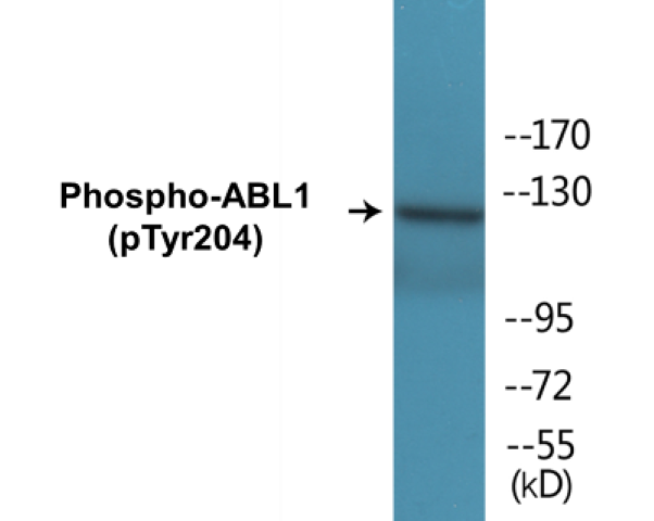 ABL1 (phospho Tyr204) Cell Based ELISA Kit