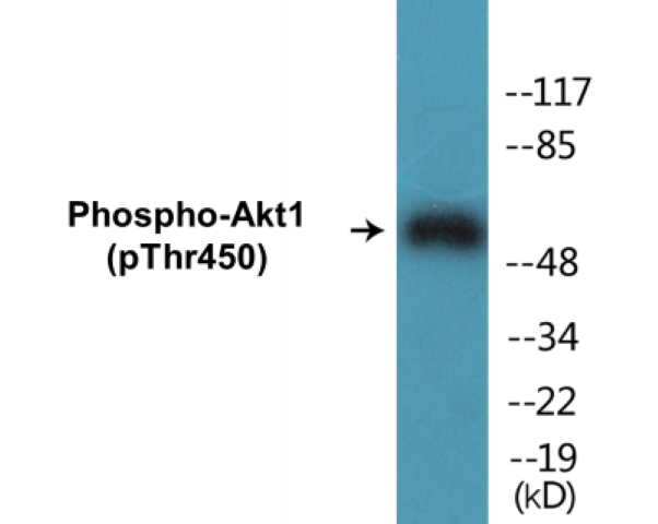 Akt1 (phospho Ser124) Cell Based ELISA Kit