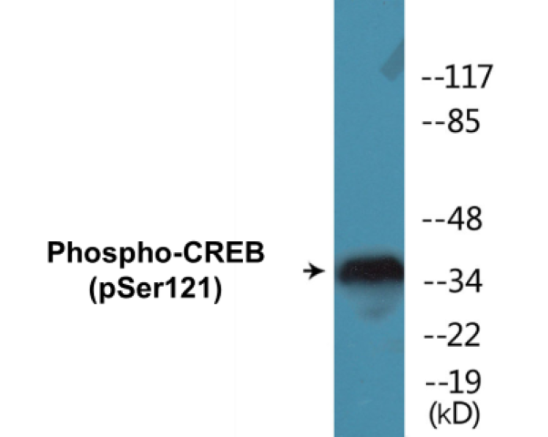 CREB (phospho Ser121) Cell Based ELISA Kit