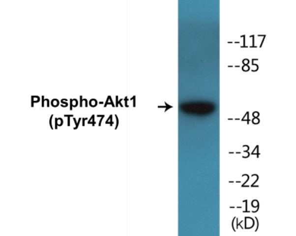 Akt1 (phospho Tyr474) Cell Based ELISA Kit
