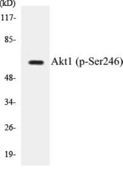 Akt1 (phospho Ser246) Cell Based ELISA Kit