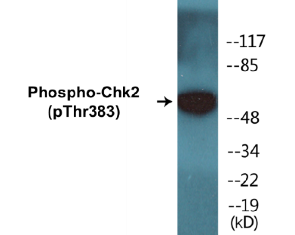 Chk2 (phospho Thr383) Cell Based ELISA Kit