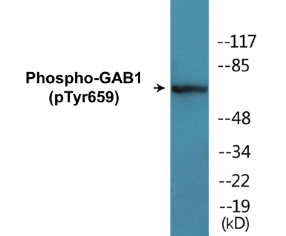 GAB1 (phospho Tyr659) Cell Based ELISA Kit