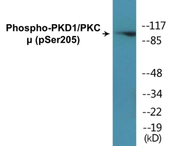 PKD1 (phospho Ser205) Cell Based ELISA Kit
