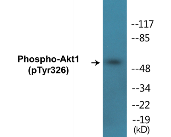 Akt1 (phospho Tyr326) Cell Based ELISA Kit