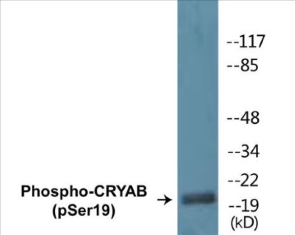 CRYAB (phospho Ser19) Cell Based ELISA Kit