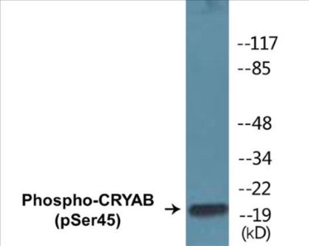 CRYAB (phospho Ser45) Cell Based ELISA Kit