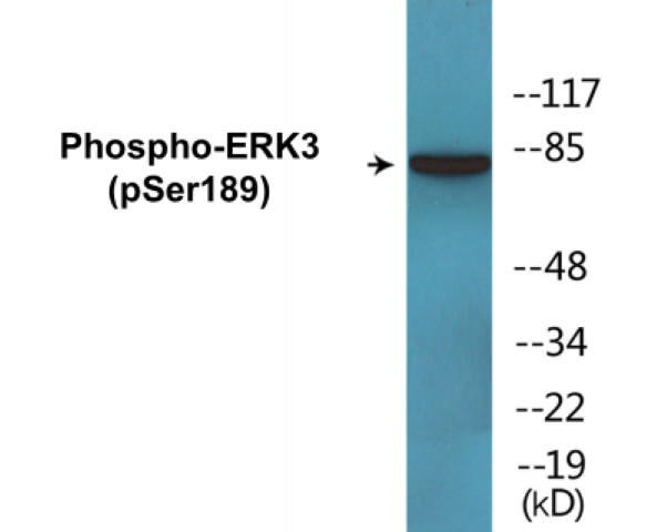 ERK3 (phospho Ser189) Cell Based ELISA Kit