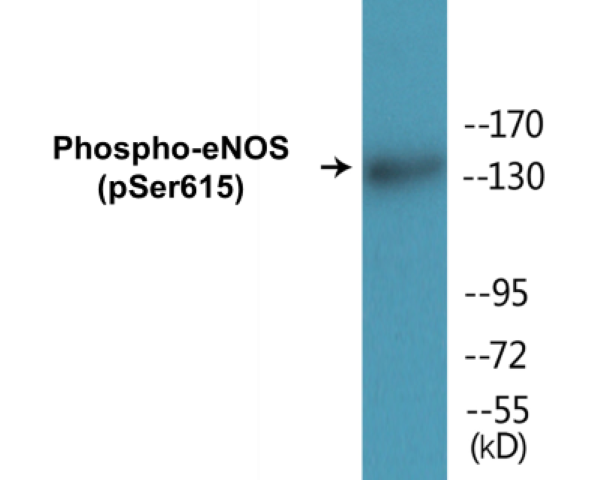 eNOS (phospho Ser615) Cell Based ELISA Kit