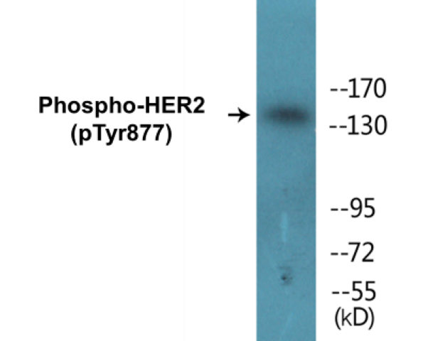 HER2 (phospho Tyr877) Cell Based ELISA Kit