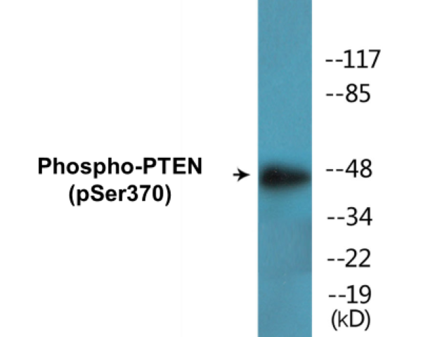 PTEN (phospho Ser370) Cell Based ELISA Kit