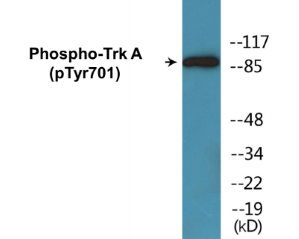 TrkA (phospho Tyr701) Cell Based ELISA Kit