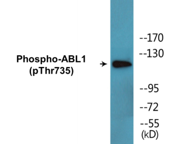 ABL1 (phospho Thr735) Cell Based ELISA Kit