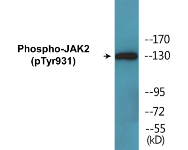 JAK2 (phospho Tyr931) Cell Based ELISA Kit