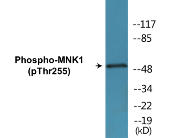 MNK1 (phospho Thr255) Cell Based ELISA Kit