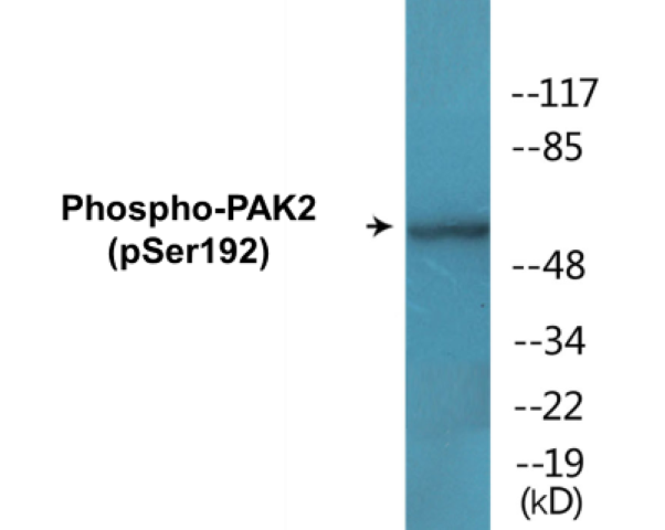PAK2 (phospho Ser192) Cell Based ELISA Kit