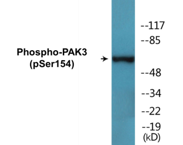 PAK3 (phospho Ser154) Cell Based ELISA Kit