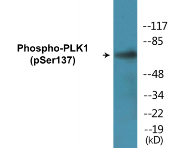 PLK1 (phospho Ser137) Cell Based ELISA Kit