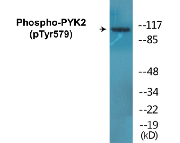 PYK2 (phospho Tyr579) Cell Based ELISA Kit