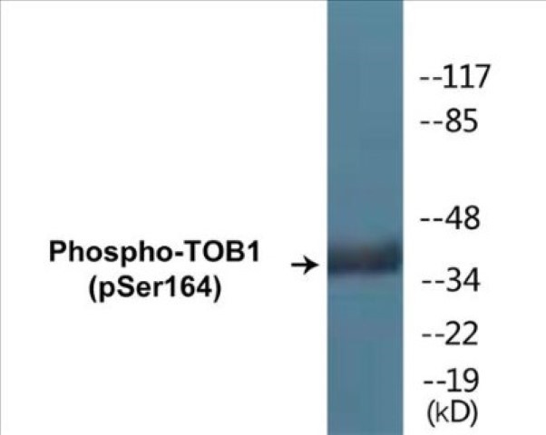 TOB1 (phospho Ser164) Cell Based ELISA Kit