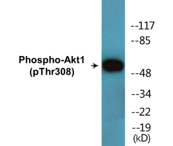Akt1 (phospho Thr308) Cell Based ELISA Kit