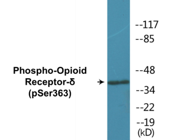Opioid Receptor delta (phospho Ser363) Cell Based ELISA Kit