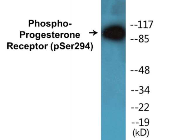Progesterone Receptor (phospho Ser294) Cell Based ELISA Kit