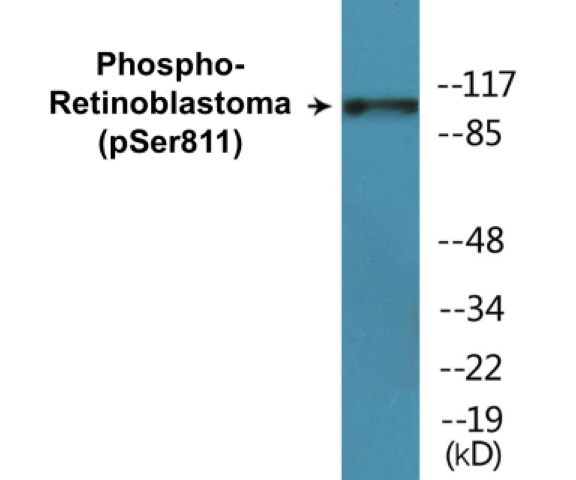 Retinoblastoma (phospho Ser811) Cell Based ELISA Kit