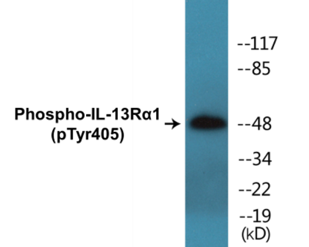 IL-13R alpha 1 (phospho Tyr405) Cell Based ELISA Kit