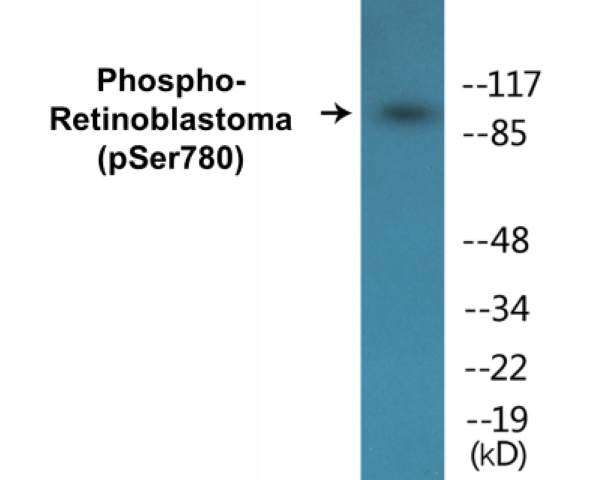 Retinoblastoma (phospho Ser780) Cell Based ELISA Kit