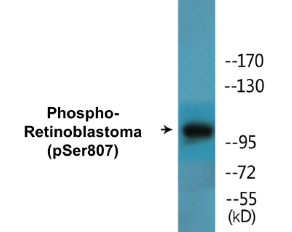 Retinoblastoma (phospho Ser807) Cell Based ELISA Kit