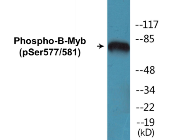 B-Myb (phospho Ser577 + Ser581) Cell Based ELISA Kit