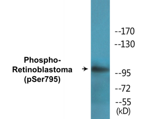 Retinoblastoma (phospho Ser795) Cell Based ELISA Kit