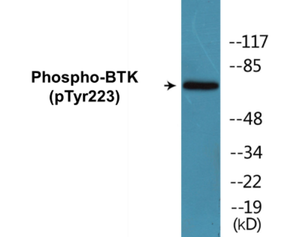 BTK (phospho Tyr223) Cell Based ELISA Kit
