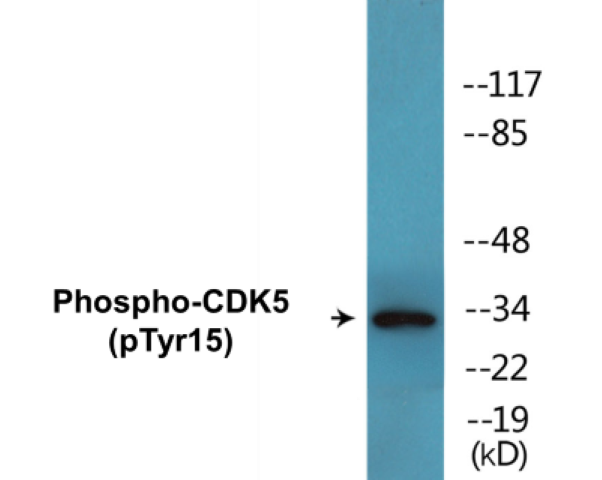CDK5 (phospho Tyr15) Cell Based ELISA Kit
