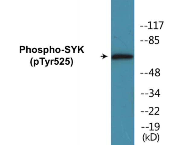 SYK (phospho Tyr525) Cell Based ELISA Kit