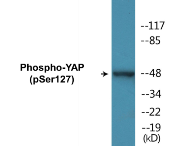 YAP (phospho Ser127) Cell Based ELISA Kit