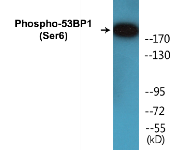 53BP1 (phospho Ser6) Cell Based ELISA Kit