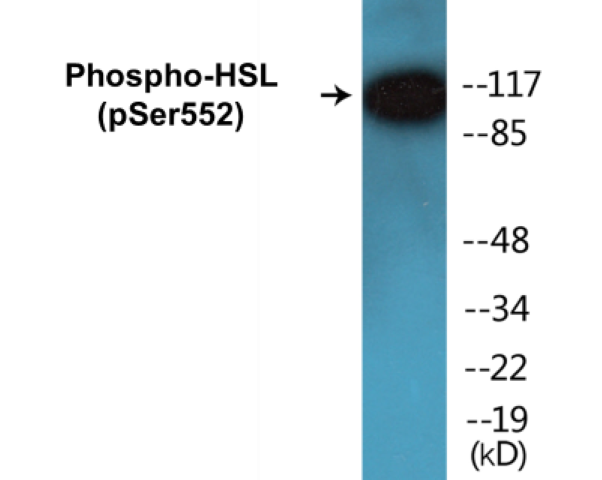 HSL (phospho Ser552) Cell Based ELISA Kit