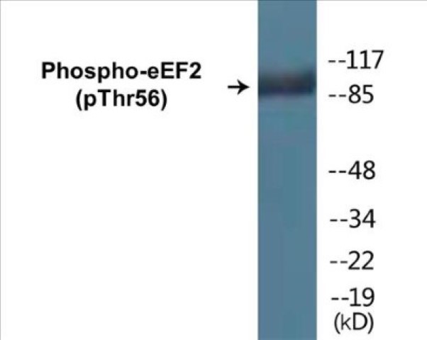 eEF2 (phospho Thr56) Cell Based ELISA Kit