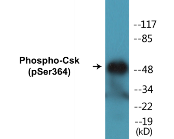 Csk (phospho Ser364) Cell Based ELISA Kit