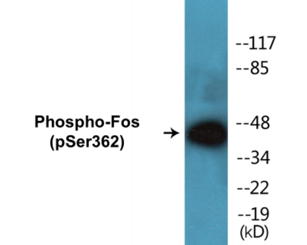 Fos (phospho Ser362) Cell Based ELISA Kit