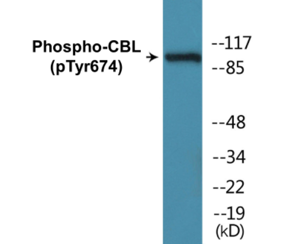 CBL (phospho Tyr674) Cell Based ELISA Kit