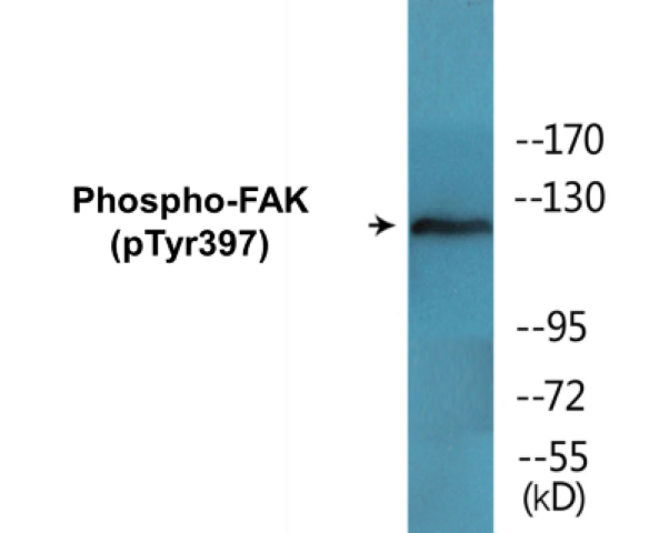 FAK (phospho Tyr397) Cell Based ELISA Kit