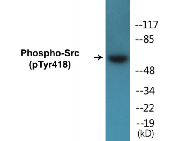 Src (phospho Tyr418) Cell Based ELISA Kit