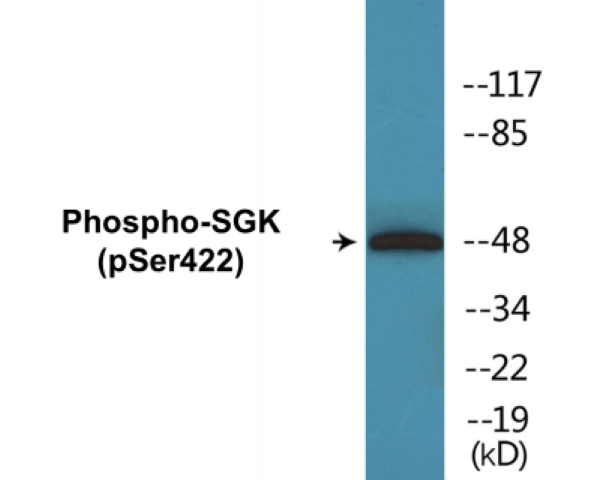 SGK (phospho Ser422) Cell Based ELISA Kit
