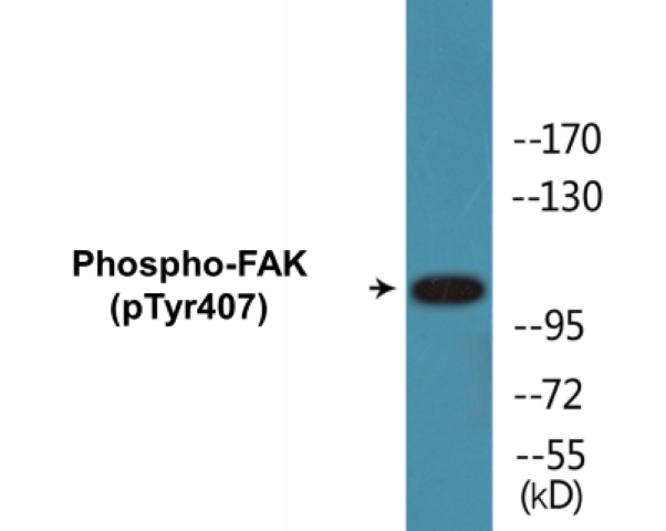 FAK (phospho Tyr407) Cell Based ELISA Kit