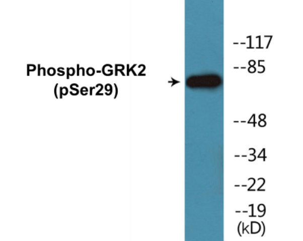 GRK2 (phospho Ser29) Cell Based ELISA Kit